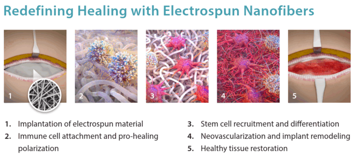 schematic of the restorative healing cascade triggered by electrospun materials